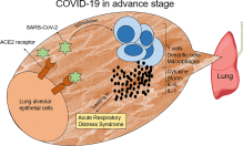 COVID-19 in patients with cancer: Risks and precautions