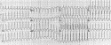 Cases in electrocardiography1 1March 30 27, 2003.
