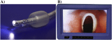 Comparison of the VivaSight single lumen endotracheal tube and the Macintosh laryngoscope for emergency intubation by experienced paramedics in a standardized airway manikin with restricted access: a randomized, crossover trial
